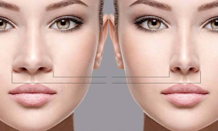 Rhinoplastie ethnique préservant les traits individuels chez EsteCenter Istanbul