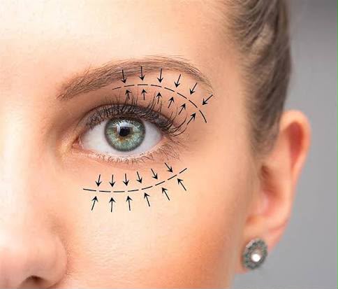 Chirurgie des paupières (blépharoplastie) chez EsteCenter Istanbul