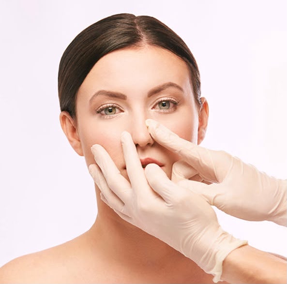 Rhinoplastie secondaire corrigeant une opération du nez antérieure chez EsteCenter Istanbul