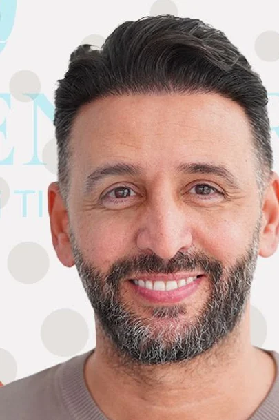 Résultat après greffe de cheveux