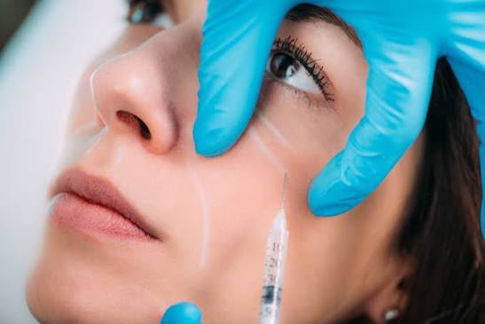 Traitement par injection de collagène chez EsteCenter Istanbul