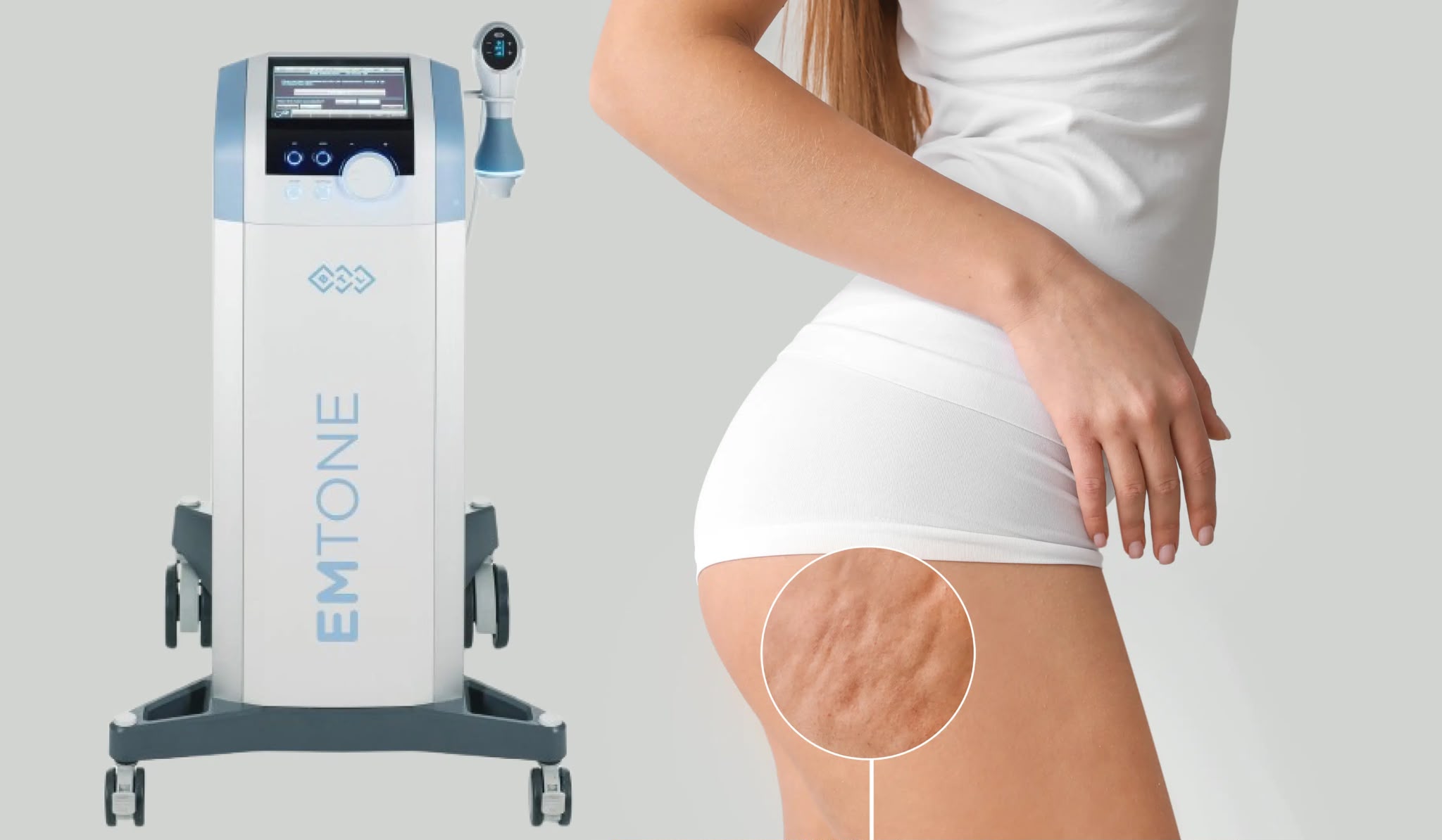 Traitement de la cellulite Emtone chez EsteCenter Istanbul