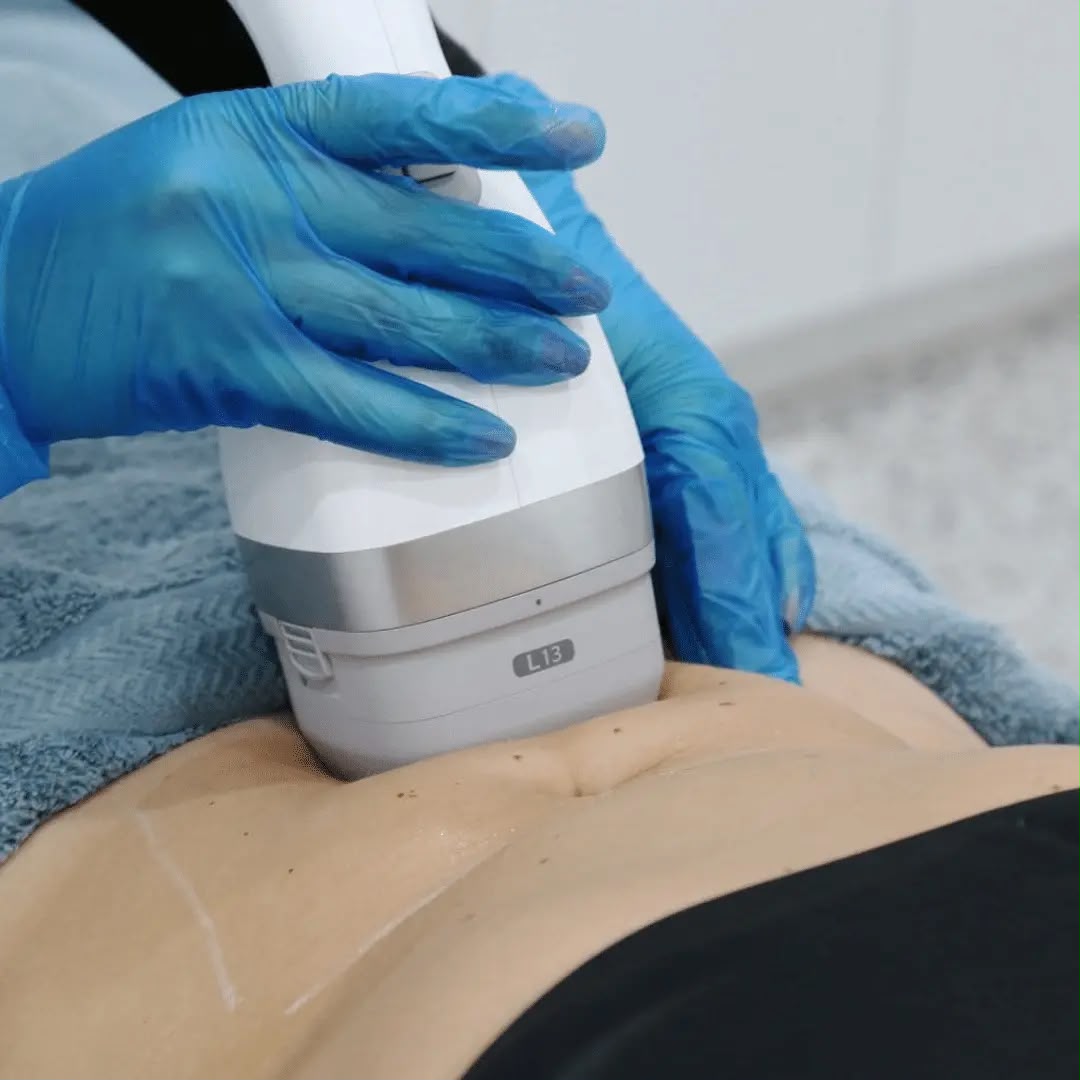 Réduction des graisses par ultrasons Lipocel Cool Sonic chez EsteCenter Istanbul
