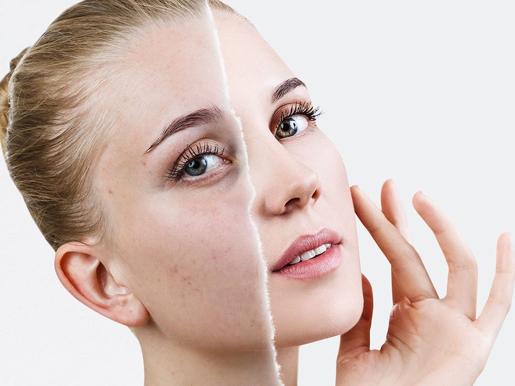 Traitement de la pigmentation chez EsteCenter Istanbul