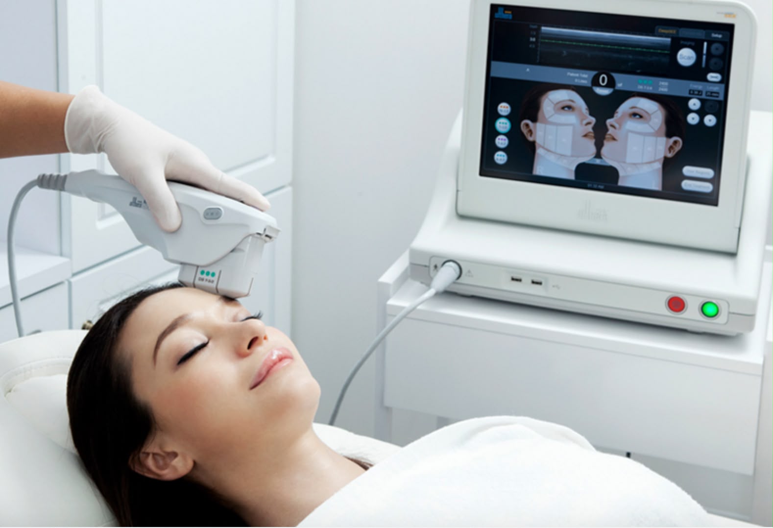 Lifting cutané par ultrasons Ultherapy chez EsteCenter Istanbul